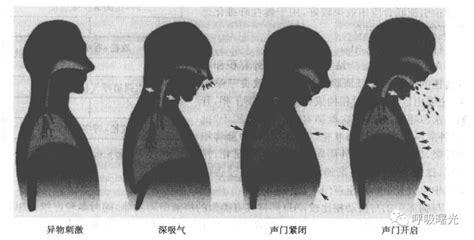 咳嗽注意事項|有效咳嗽訓練